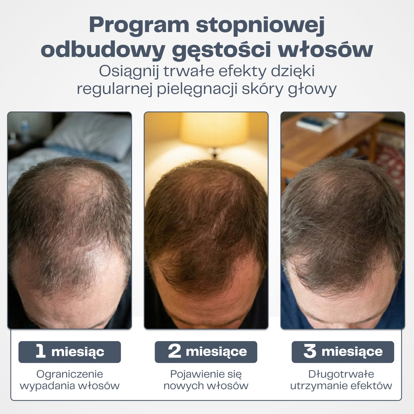 DermaWłosy System Mikro-Infuzji do Odrostu Włosów