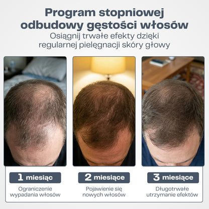 DermaWłosy System Mikro-Infuzji do Odrostu Włosów