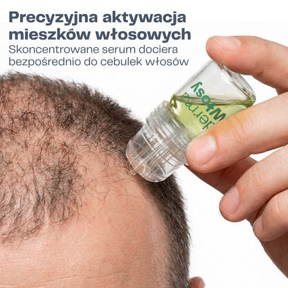 DermaWłosy System Mikro-Infuzji do Odrostu Włosów